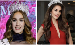 Miss Turkey birincisi İdil Bilgen estetik mi yaptırdı?