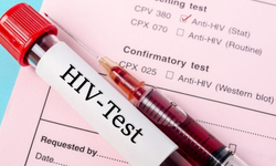 HIV ve AIDS nedir? Riskler ve korunma yöntemleri