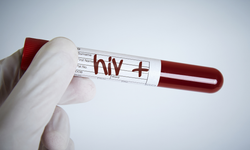 İzmir'de nerede HIV testi yaptırabilirsiniz?