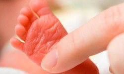 Bebeklerde görülen Fenilketonüri hastalığı nedir?