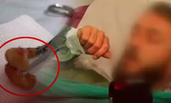 Uykuda dişini yuttu, ciğerinden çıktı!