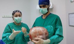 2 ayda hızlı büyüyen karnından karpuz kadar kitle çıkarıldı