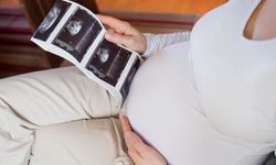 Uzmandan uyarı: Sigara, gebelik şansını yüzde 40 azaltıyor