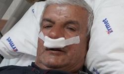 Burun tıkanıklığının nedeni 100 gramlık taş çıktı