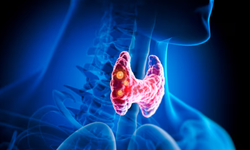 Kilo kaybı ve çarpıntıya dikkat! Zehirli guatrın ilk işaretleri