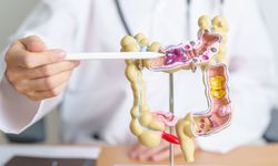 Kolorektal kanser dünya genelinde en yaygın üçüncü kanser