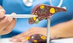 Prof. dr. Kabaçam Türkiye’de karaciğer yağlanmasının kritik seviyeye ulaştığını açıkladı