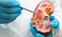 Şok dalga tedavisi lipödemde ağrı ve doku sertliğini azaltıyor