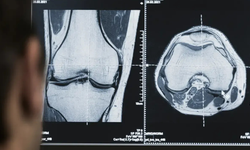 İzmir’de radyoloji skandalı meclis gündeminde: “Yanlış tanı” iddiaları