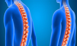 Ortopedide yapay zeka ve robot teknolojileri dönemi