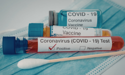 Ağır geçirilen Kovid veya grip yıllar sonra akciğer kanseri riskini artırabilir