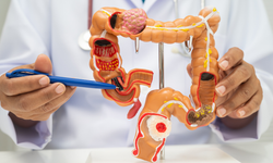 Kanser ve bağırsak hastalıklarında yeni erken uyarı sistemi