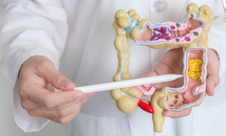 Bağırsak kanserinde erken uyarı işaretleri: Belirtiler neden kritik?