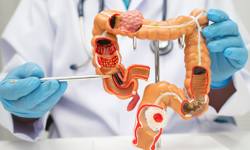 Bağırsaktaki gizli virüs kolon kanseriyle ilişkilendirildi