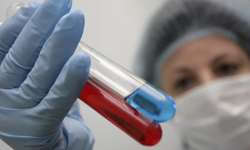 Türkiye’de HIV alarmı: Vakalarda artış yaşanıyor