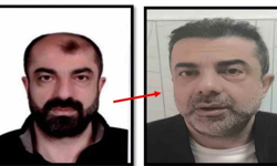 9 estetik operasyonla yüzünü değiştirdi: 11 yıl sonra İzmir'de yakayı ele verdi