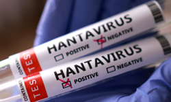 Hantavirüs şüphesinde 3 Türk vatandaşının testi açıklandı