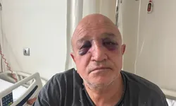 İzmir’de oda başkanına saldırı: Bir şüpheli tutuklandı