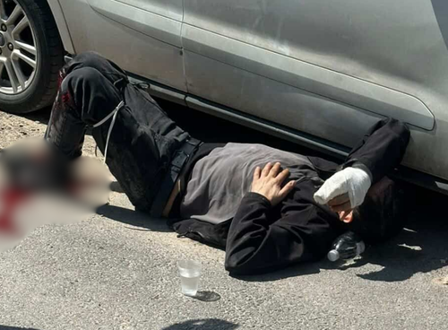 Bornova’da silahlı çatışma: Bir kişi yaralandı, iki şüpheli gözaltında