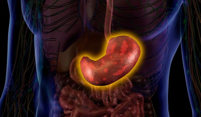 Bağırsaktan yeni mide: Nadir operasyon başarıyla yapıldı