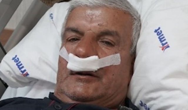 Burun tıkanıklığının nedeni 100 gramlık taş çıktı