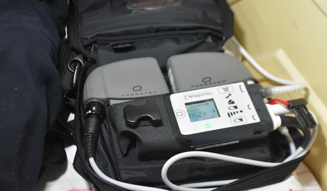 Çift taraflı yapay kalp cihazıyla hayata tutundu!