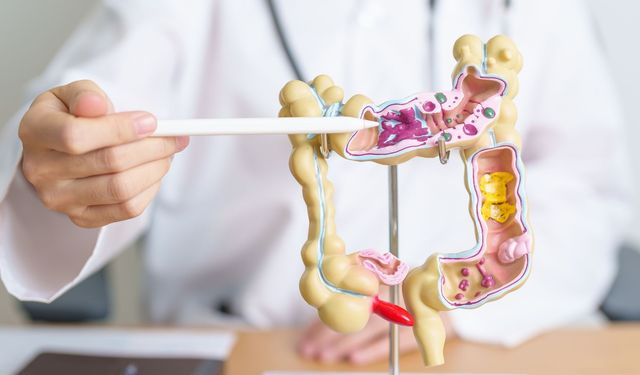 Kolorektal kanser dünya genelinde en yaygın üçüncü kanser