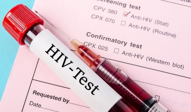 Türkiye’de HIV vakalarında artış: Sessiz pandemi uyarısı