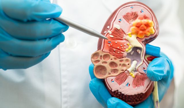 Şok dalga tedavisi lipödemde ağrı ve doku sertliğini azaltıyor