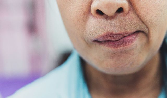 Uzmanı uyardı: Yüz felci riskine karşı soğuk havalarda yüzünüzü koruyun