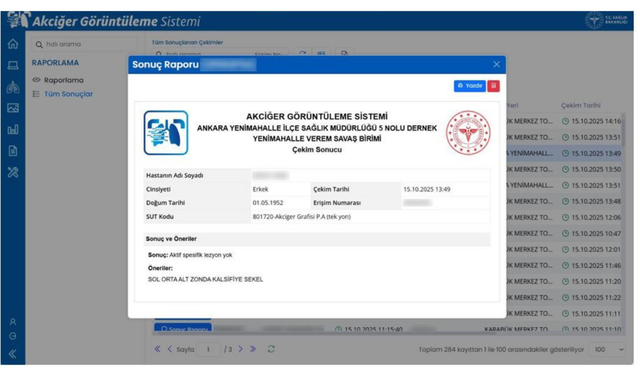 Verem dispanserlerindeki akciğer görüntüleri e-Nabız’a taşındı
