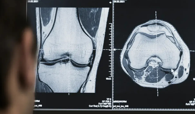 İzmir’de radyoloji skandalı meclis gündeminde: “Yanlış tanı” iddiaları