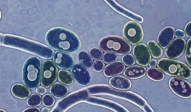 İlaca dirençli ölümcül mantar alarmı: 50’den fazla ülkeye yayıldı