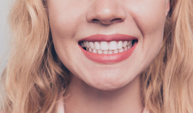 Geçmeyen baş ağrısının nedeni diş sıkma olabilir!