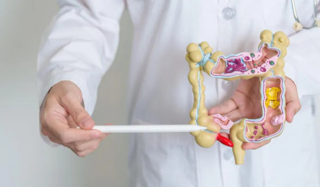 Kolon kanserine karşı uyarı: Yaşam tarzı riski artırıyor