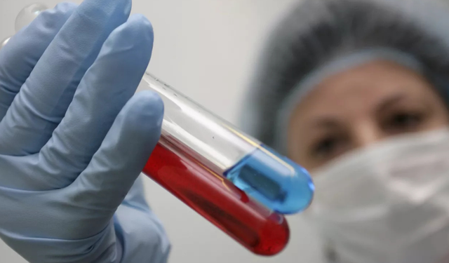 Türkiye’de HIV alarmı: Vakalarda artış yaşanıyor