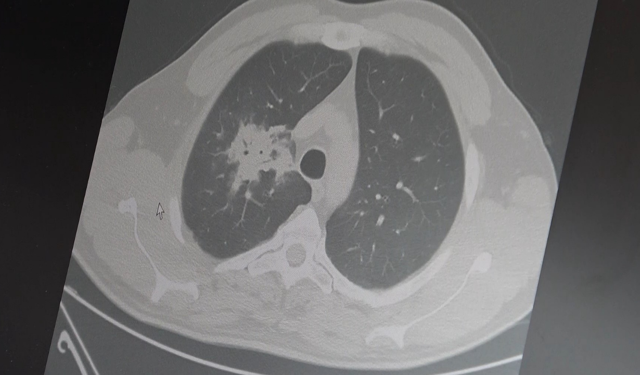 Elektronik sigarada kanser riski bilimsel olarak doğrulandı