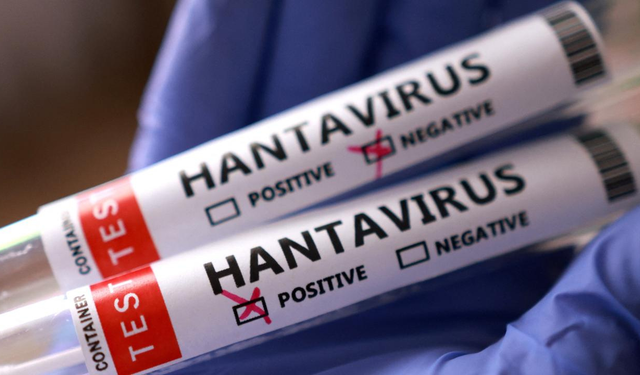 Hantavirüs şüphesinde 3 Türk vatandaşının testi açıklandı