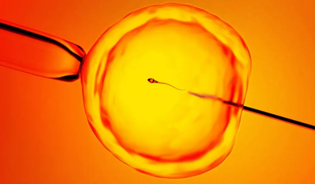 Kısırlık tedavisinde yeni umut: Yapay zeka sperm hücrelerini tespit ediyor
