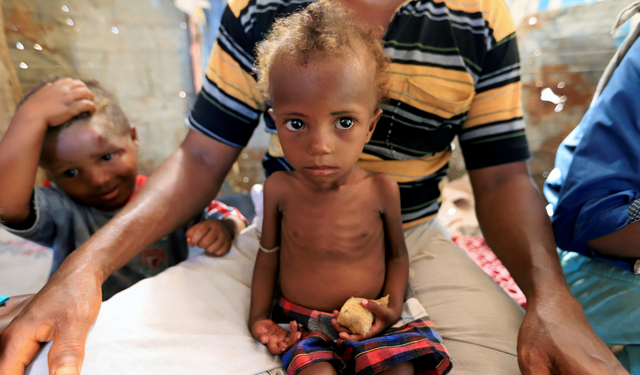 UNICEF’ten Yemen için kritik uyarı: 2,2 milyon çocuk akut beslenme yetersizliği yaşıyor