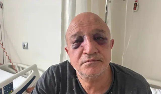 İzmir’de oda başkanına saldırı: Bir şüpheli tutuklandı
