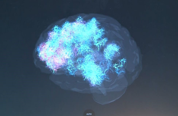 Nöroloji uzmanından uyarı: Sanal şiddet gerçek hayata taşınabilir