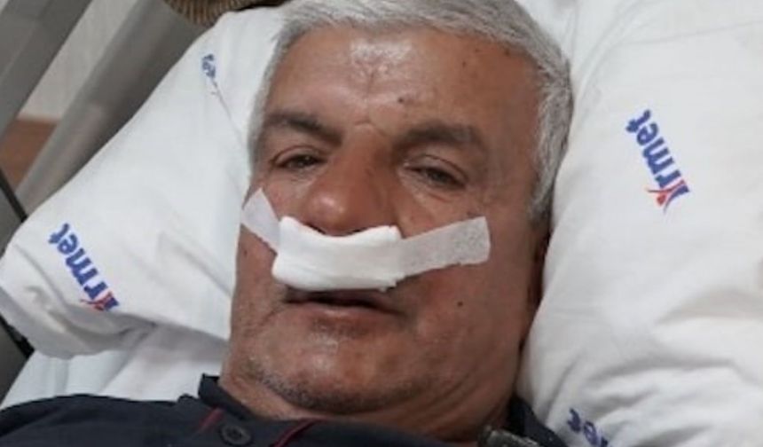 Burun tıkanıklığının nedeni 100 gramlık taş çıktı