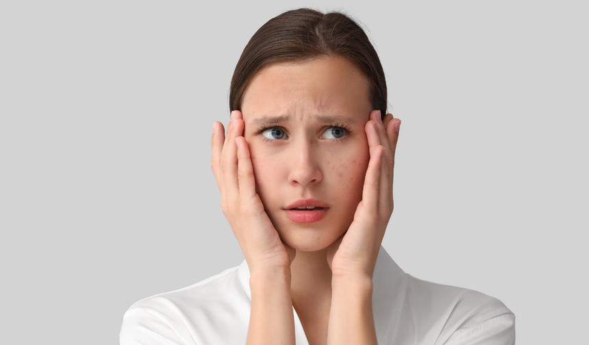 Stresin cilde etkileri ve başa çıkma yolları