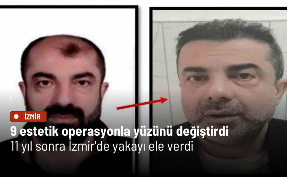 9 estetik operasyonla yüzünü değiştirdi: 11 yıl sonra İzmir'de yakayı ele verdi