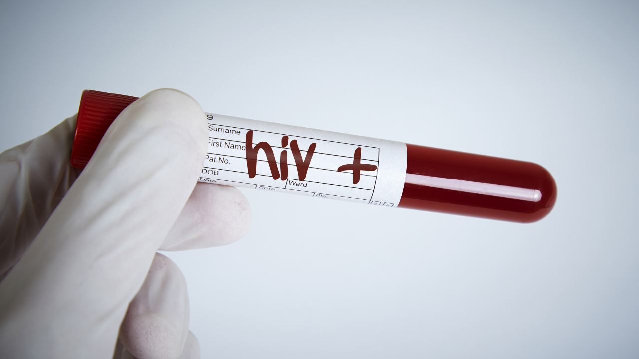 Hiv 1 Ve Hiv 2 Nedir Aralarındaki Farklar Ve Test Yöntemleri! (3)