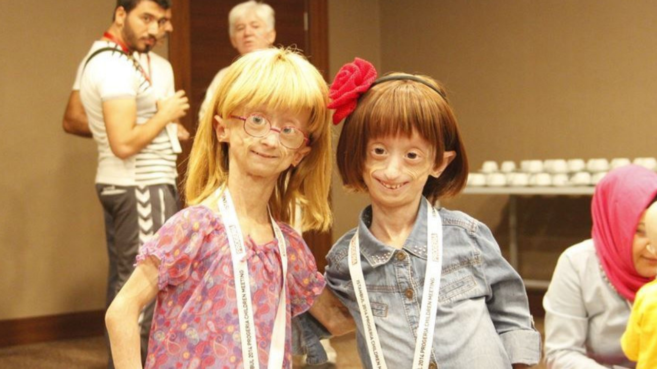 Progeria1