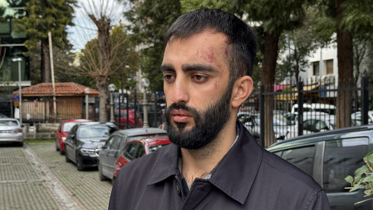 Bıçaklı Saldırı3