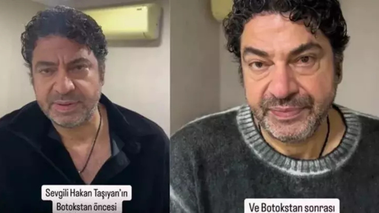 Ölümden Dönen Hakan Taşıyan Estetik Ameliyat Oldu!