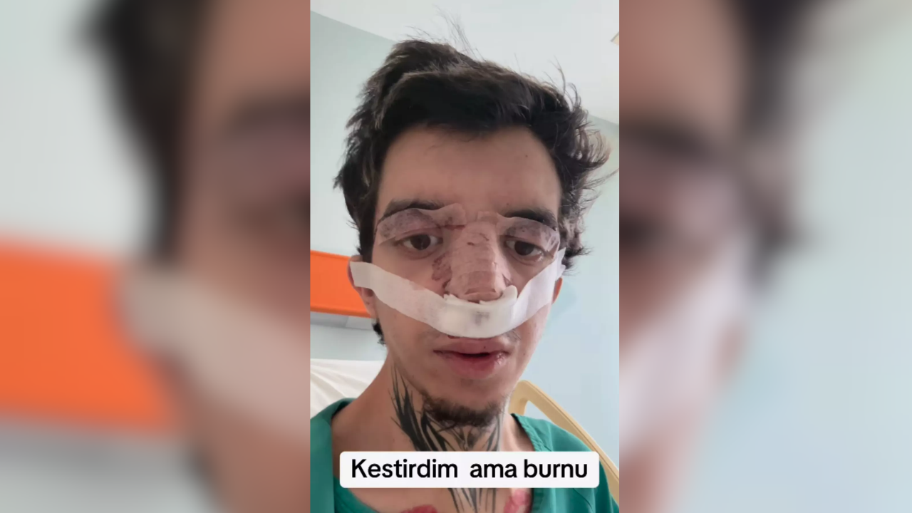 Kestirdim Ama Burnu